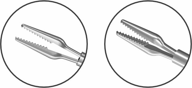 TMV170 23G Micro Incision Forceps "Crocodile" Serrated Tips Curved wp2 | TITAN MEDICAL