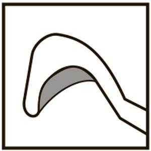 TMK138 Phaco Splitter Right - Titan Medical Instruments